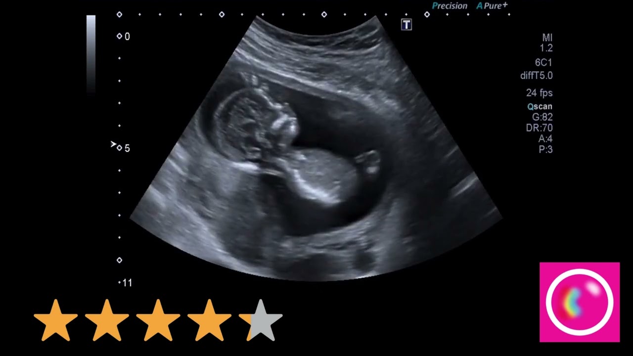 Happy motherhood❣️