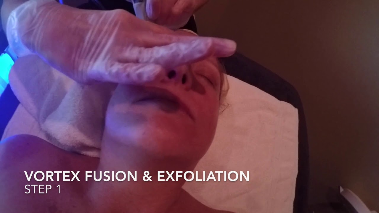 Hydrafacial Radiance Medspa Avon CT YouTube