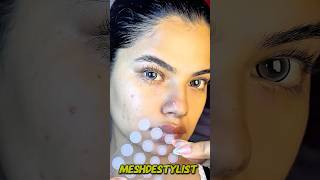Pimples Pop Technique
