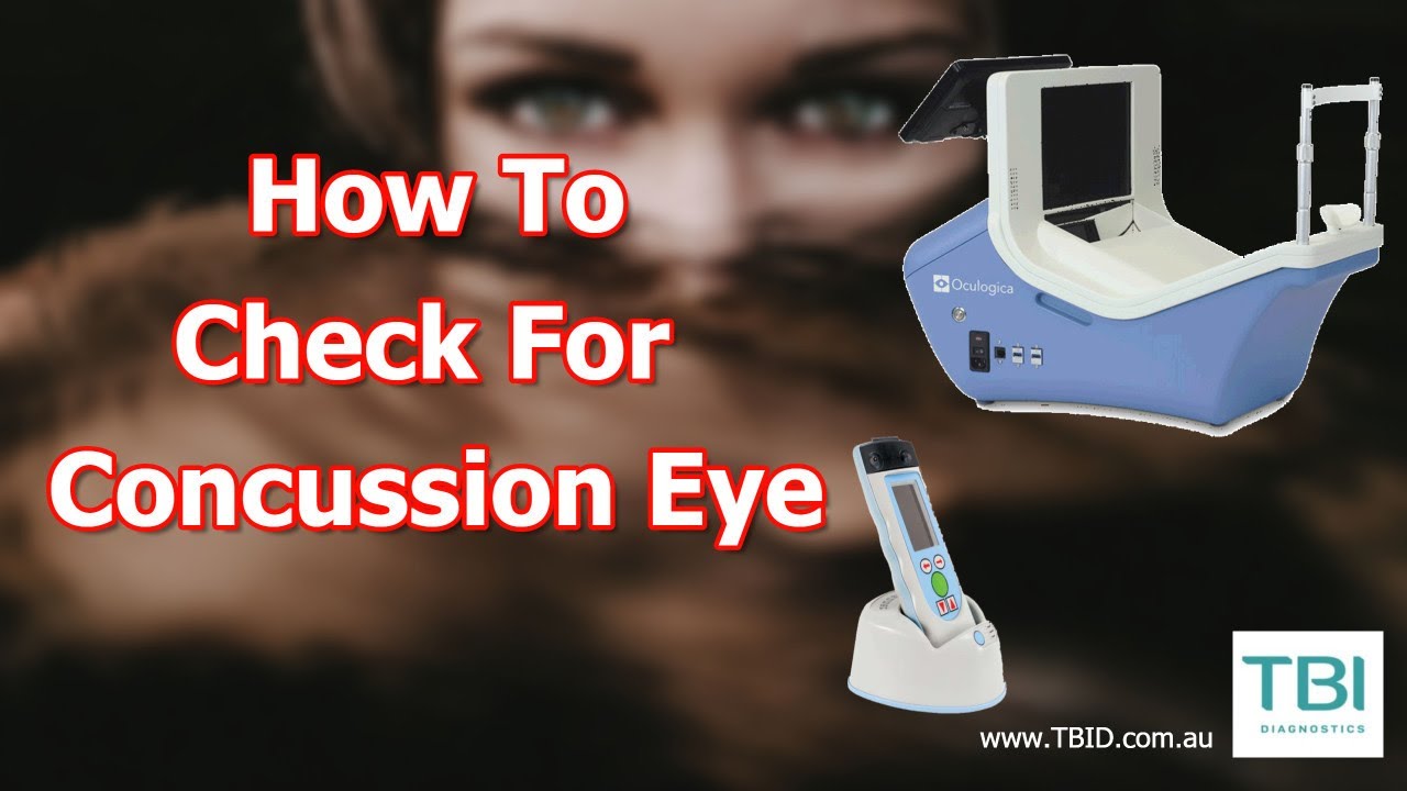 How To Check For Concussion Eyes YouTube
