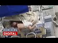 Bebé se fractura tras caer de una incubadora en un hospital de Brasil