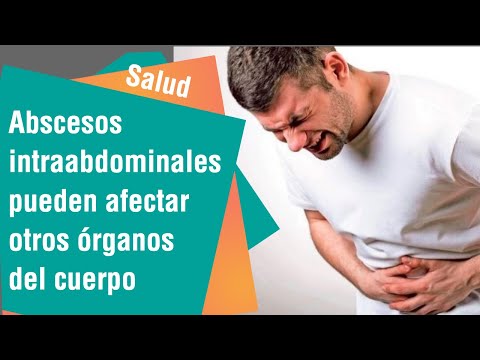 Vídeo: Absceso Abdominal: Un Dolor Importante En La Barriga