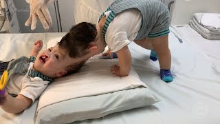 Gêmeos que nasceram unidos pela cabeça fazem cirurgia 31/07/2022