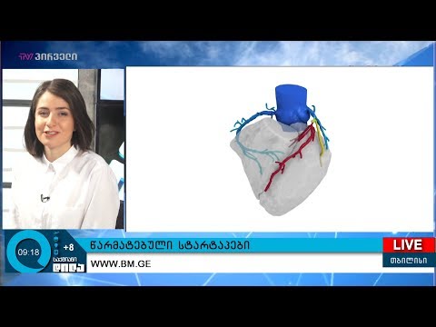 წარმატებული სტარტაპები