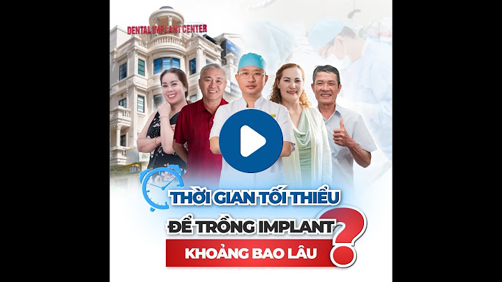 Mất toàn hàm trồng bao nhiêu implant là tối thiểu năm 2024