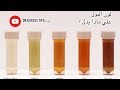 لون البول ماذا يخبرك لون البول عن جسمك لون البول ماذا يخبرك لون البول عن جسمك