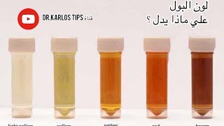 لون البول | ماذا يخبرك لون البول عن جسمك