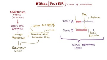 Atrial flutter type 1, type 2   causes, symptoms, diagnosis, treatment, pathology