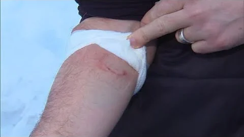 Dad kills coyote with bare hands after animal attacked his son