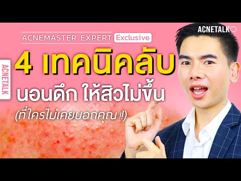 4 เทคนิคลับ นอนดึกยังไง ไม่ให้สิวขึ้น สิวขึ้นไม่หายต้องดู !! l AcneTalk