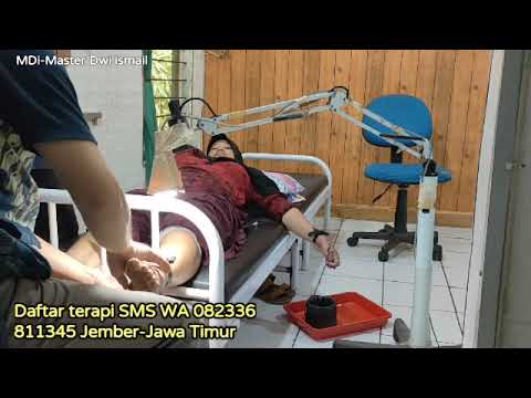 Tempat terapi rehabilitasi penyembuhan stroke, pengobatan stroke, yang bagus di Jember Jawa Timur.