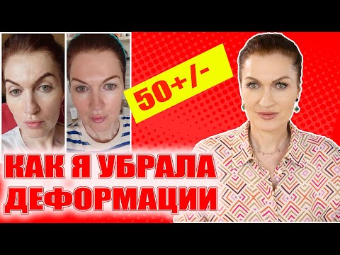 Как я победила деформации лица! 💥💥💥 Что работает, а что нет! Не лекция, а практический опыт!