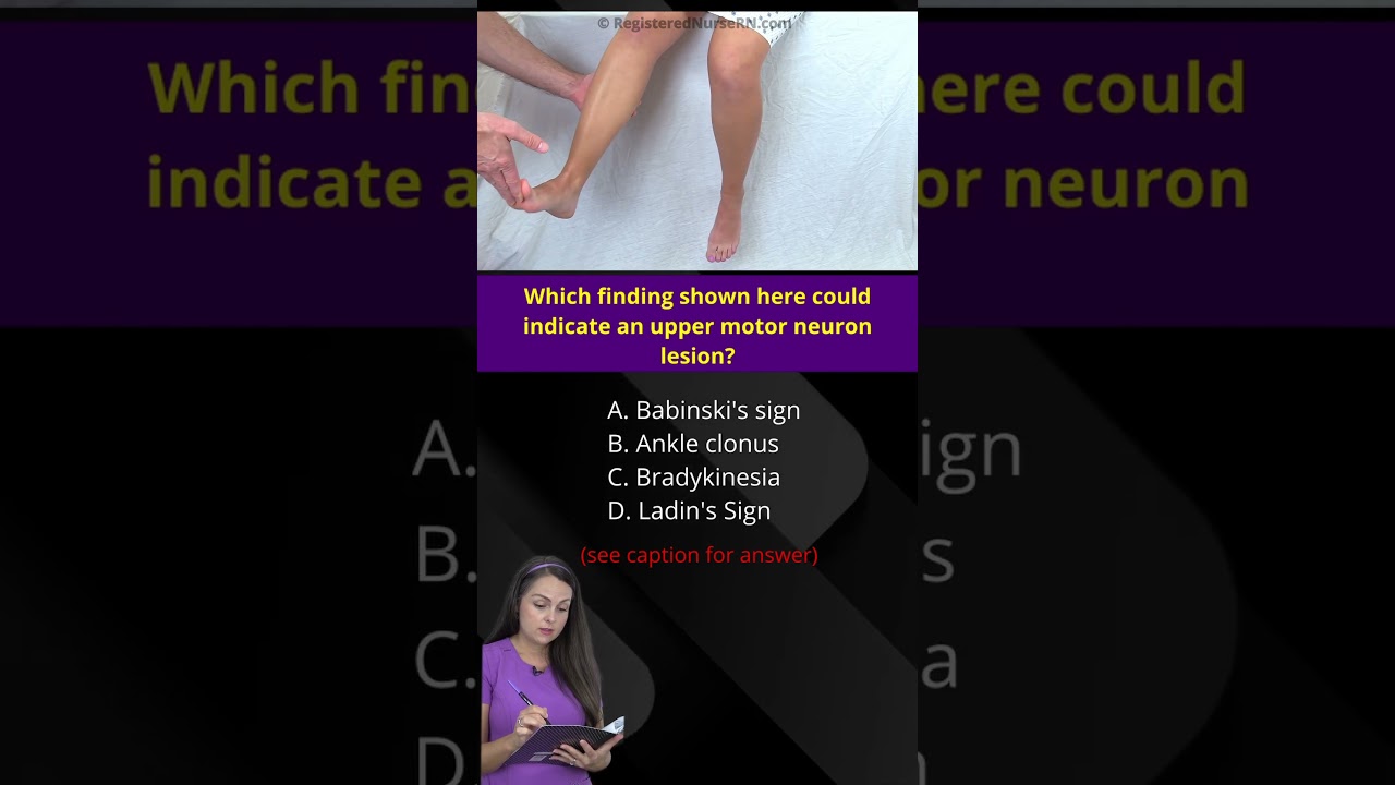 Nurse Quiz: Which Clinical Sign Shown Suggest Upper Motor Neuron Lesion #shorts