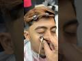 The removal of the blackhead from the face😳✂️#fyp #foryou #foryoupage #viral #explore #comedy #asmr