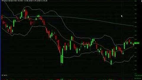 Iron Condor *Options Trading* Stock Market Income Strategy