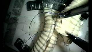 Laparoscopic training for speed
