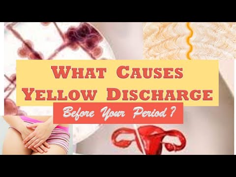 What Causes Yellow Discharge Before Your Period?