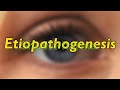 Glucoma, ophthalmic disorder symptoms treatment pathophysiology of pharmacy
