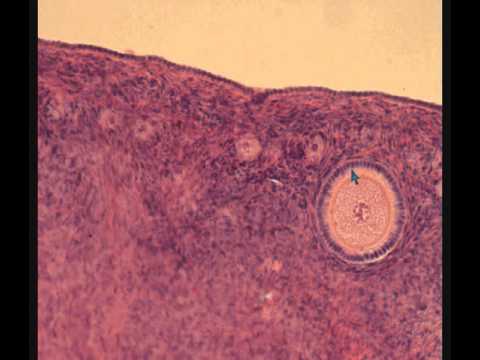 ЯИЧНИК  гистологическое строение  OVARY