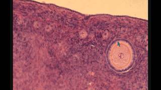 ЯИЧНИК гистологическое строение OVARY ЯИЧНИК гистологическое строение OVARY