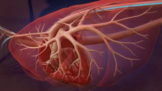 Heartworm Life Cycle for Professionals