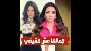 فيديو عفوي يكشف شعر رضوى الشربيني الحقيقي.. بتلبس باروكة وشكلها قبل عمليات التجميل يثير الجدل