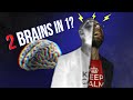 The Curious Case of the People With Split Brains