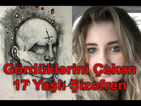 Video: Niyə mən həmişə halüsinasiyalar görürəm?