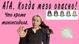 видео: Андрогенная алопеция у женщин. Как уменьшить выпадение волос без миноксидила. Обязательно трихолог? картинка: Андрогенная алопеция у женщин. Как уменьшить выпадение волос без миноксидила. Обязательно трихолог?