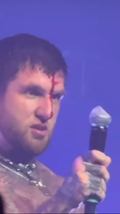 Alex Terrible Loses It – Bloody Mic Self-Destruction!