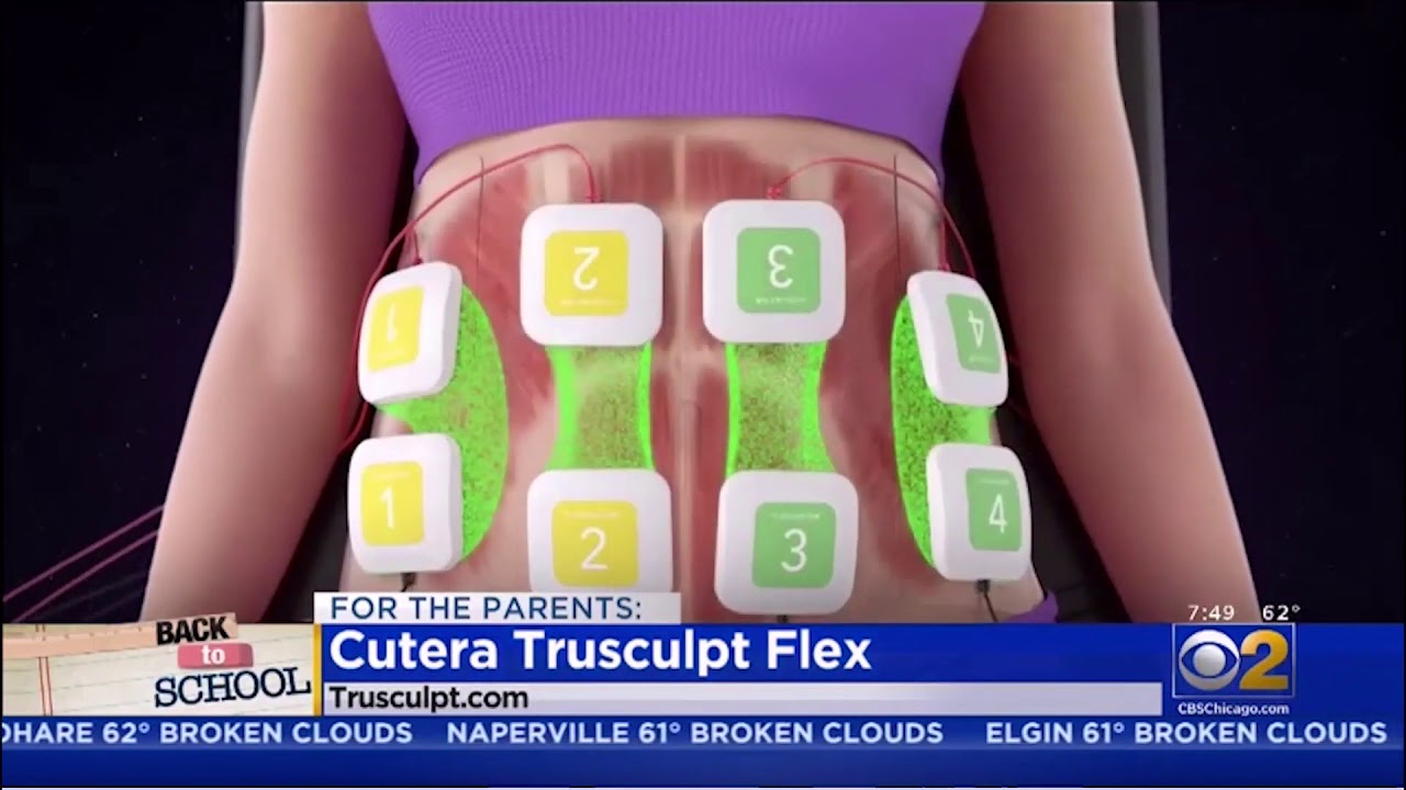 How TruSculpt Flex Works YouTube
