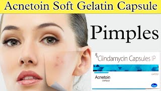 Acnetoin Soft Gelatin Capsule | Clindamycin Hydrochloride Capsule | Uses | Dose | Side-effects screenshot 5