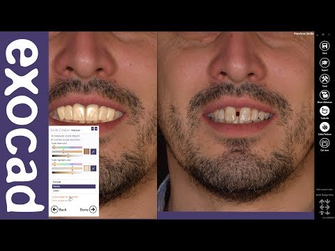 exocad Quick Guide: Learn Smile Creator in 7 min!