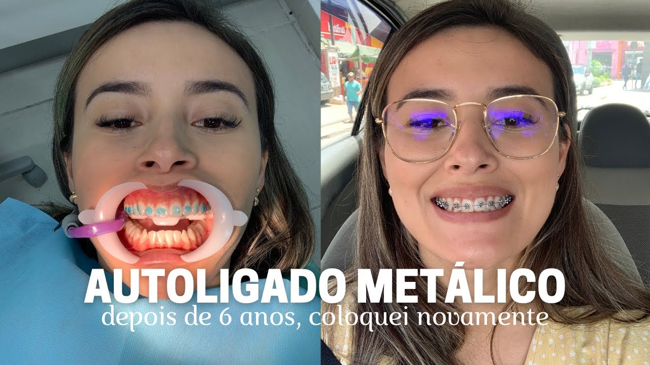 COLOQUEI APARELHO DE NOVO 😱