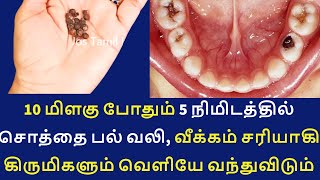 மிளகு போதும் சொத்தை பல் பூச்சிகள் வெளியேறி சொத்தைப்பல் சரியாகிவிடும் | cavity remedy