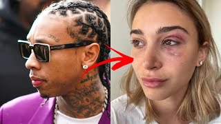Tyga's Ex Accuses Him of Beating On Her!