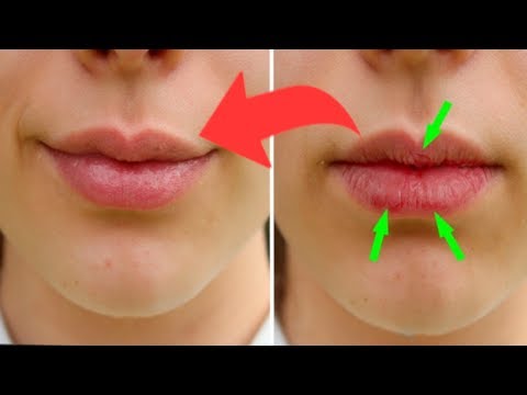 Wideo: Domowe Sposoby Na Spierzchnięte Usta: 5 Naturalnych Zabiegów DIY
