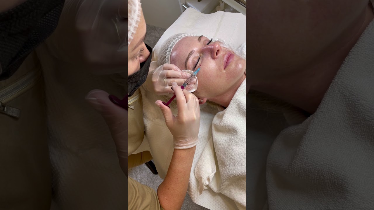 Teosyal Redensity | Beauty clinic Roksolana