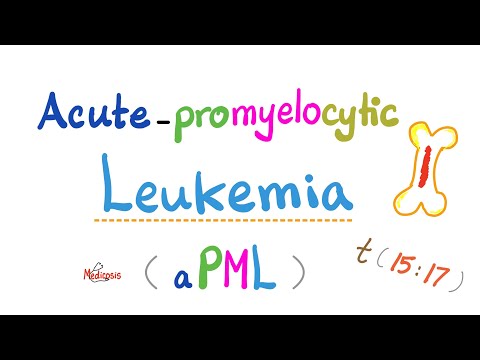 Videó: Egy Akut Promyelocytic Leukémia Variáns 3 Der (3) T (3; 8) Kromoszómával, 8q Részleges Nyereséggel Társítva
