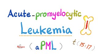 Acute Promyelocytic Leukema (aPML) | t(15;17) | AML_M3 | ATRA