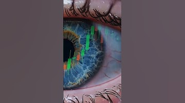 VIX: The Stock Market’s Fear Gauge Explained 📈😨