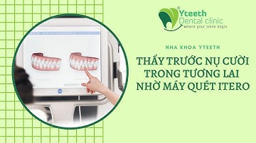 MÁY QUÉT TRONG MIỆNG ITERO - Nha khoa YTEETH