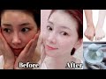 New japanese secret to whitening skin and get rid of pigmentation to get a milky fresh complexion