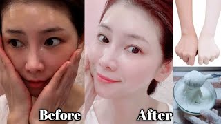 New Japanese Secret To Whitening Skin And Get Rid Of Pigmentation To Get a Milky Fresh Complexion