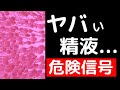 【科学的に解説】精液があれだとヤバいかも