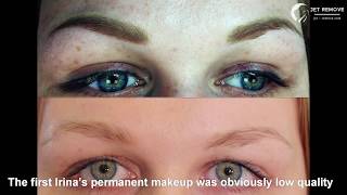 Полное удаление татуажа бровей и век. Отзыв Ирины. Тату Ремувер Jet Remove. PMU tattoo remover Полное удаление татуажа бровей и век. Отзыв Ирины. Тату Ремувер Jet Remove. PMU tattoo remover