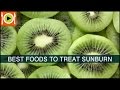 Best Foods to Treat Sunburn | Including Vitamin A &amp; Protein Rich Foods