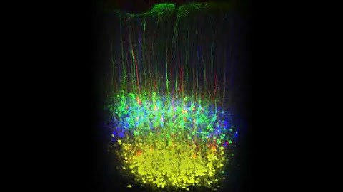 How the Brain Is Wired: Connectivity Axon Pathways