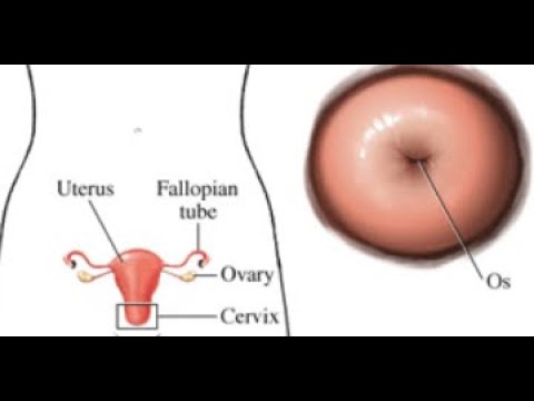 Video: Sel B Yang Menginfiltrasi Tumor Memengaruhi Perkembangan Karsinoma Sel Skuamosa Orofaringeal Melalui Interaksi Sel Ke Sel Dengan Sel T CD8 +