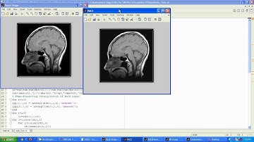 An Interpolated Phase Adjustment by Contrast Enhancement Algorithm for SAR